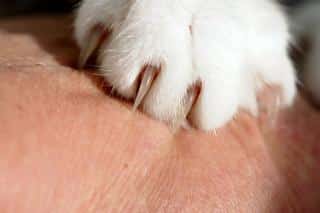 la-maladie-des-griffes-du-chat La maladie des griffes du chat, une maladie transmissible aux humains